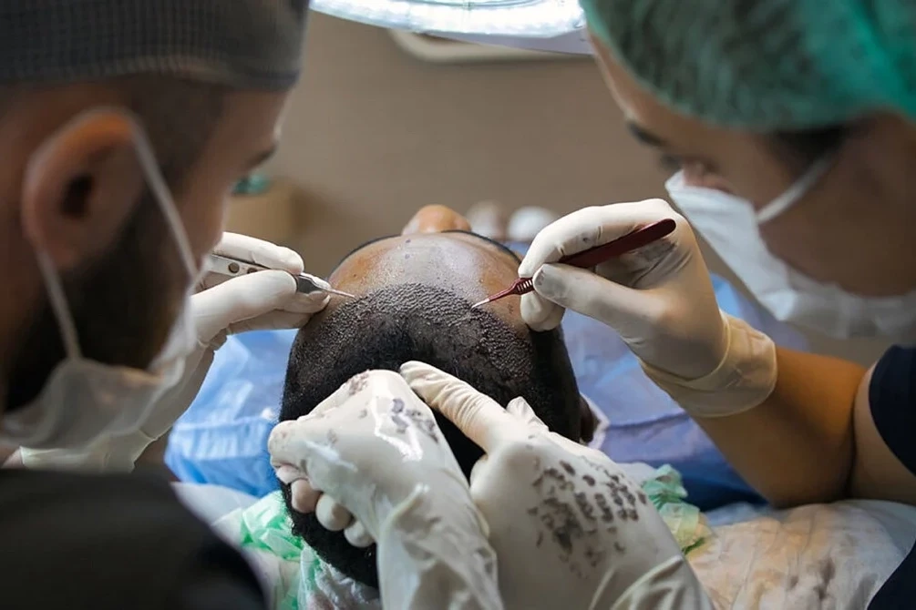 Sağlık Bakanlığı’ndan saç ekimi birimlerinde yeni dönem